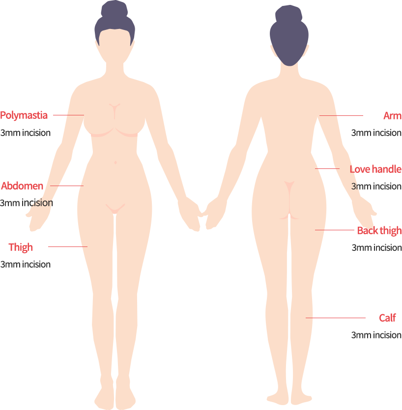 body_lip01_m model img