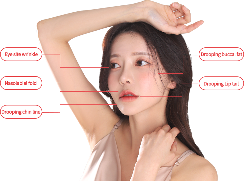 mini incisio model img