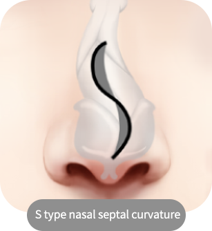 nose_type 50