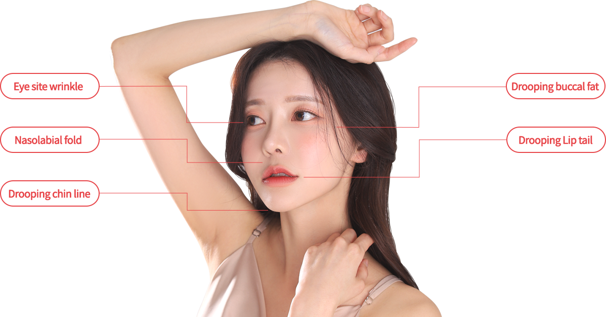 mini incisio model img