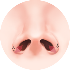 nose_type21