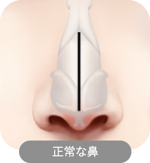 nose_type 48