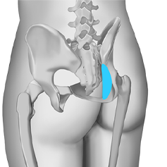rhinoplasty_img03 img