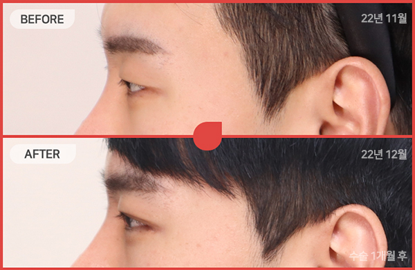 ด้านข้างของใบหน้า