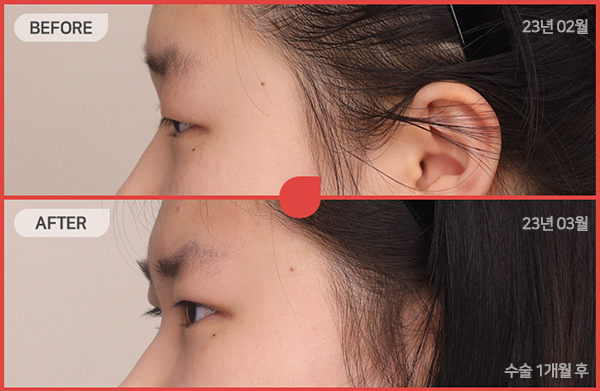 ด้านข้างของใบหน้า