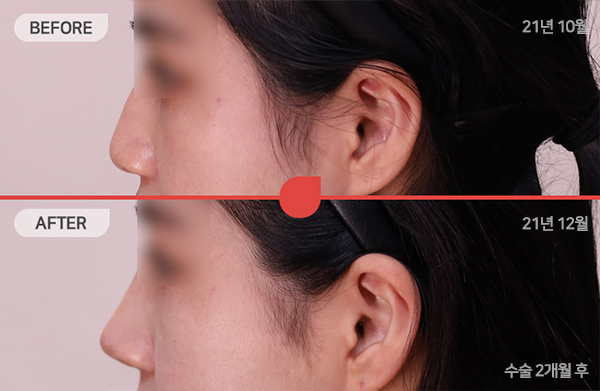 ด้านข้างของใบหน้า