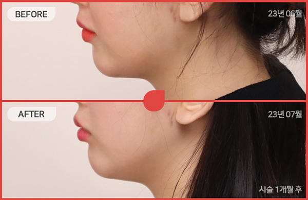 ด้านข้างของใบหน้า