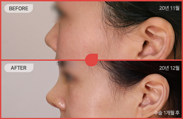 ด้านข้างของใบหน้า