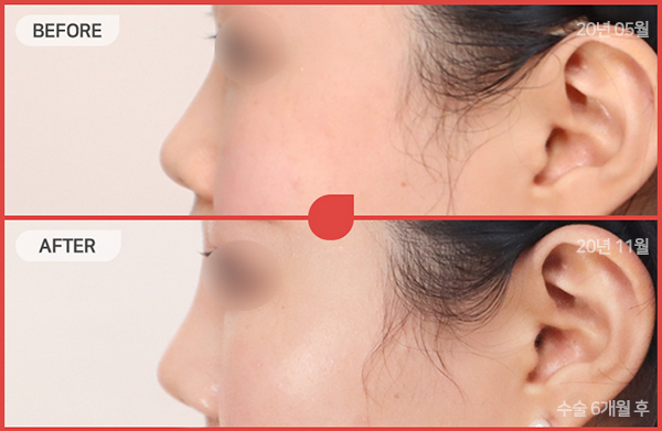 ด้านข้างของใบหน้า