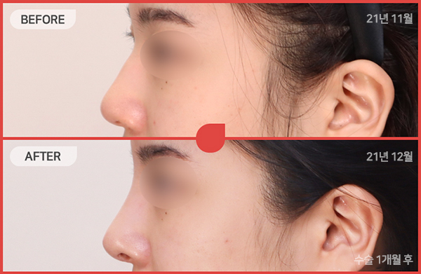 ด้านข้างของใบหน้า