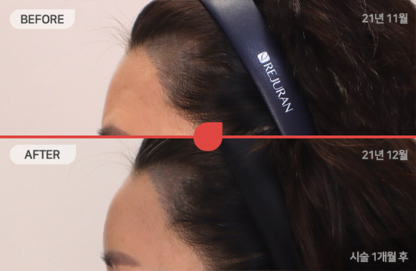 ด้านข้างของใบหน้า