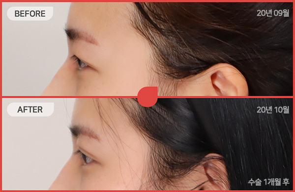 ด้านข้างของใบหน้า