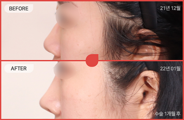 ด้านข้างของใบหน้า