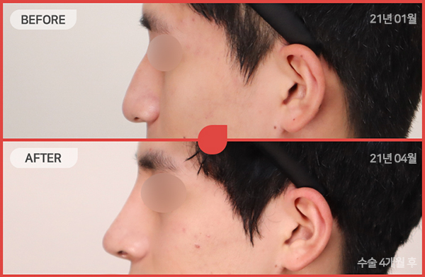 ด้านข้างของใบหน้า