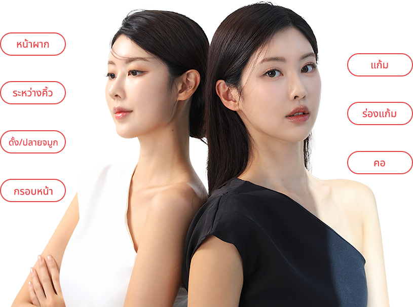 radiesse region model img