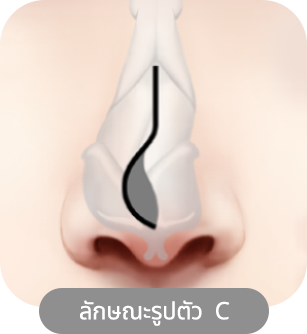 nose_type 49