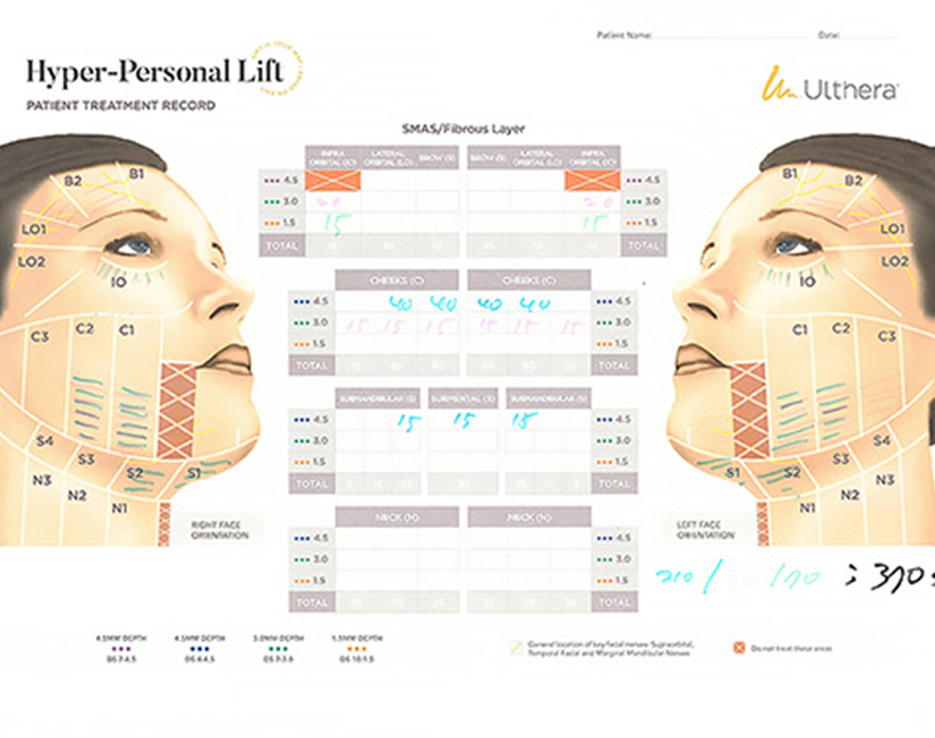 ulthera_img