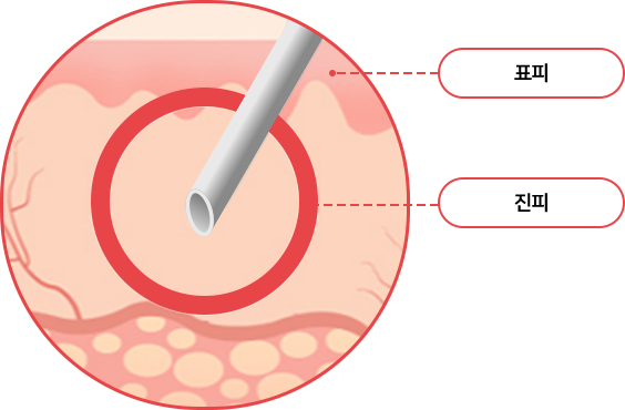 hand_img02 comparison02