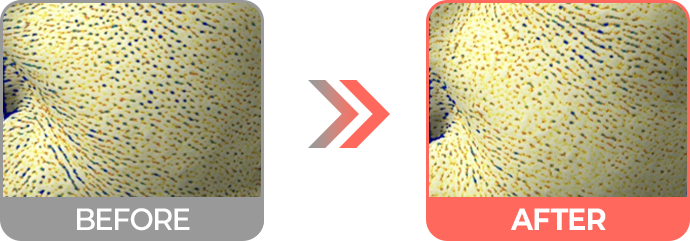 리투오 효과 모공 크기 감소