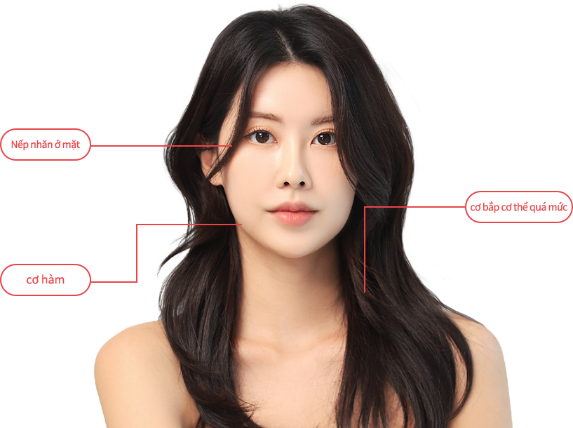 botox region model img