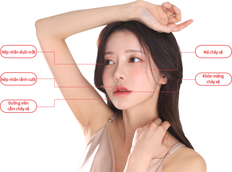 mini incisio model img