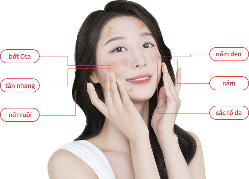 mobile region model img