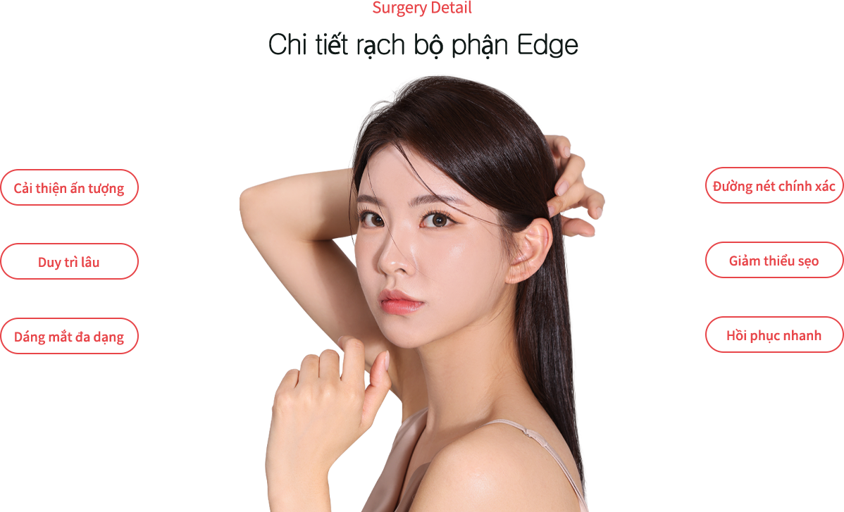 eye_incision model img