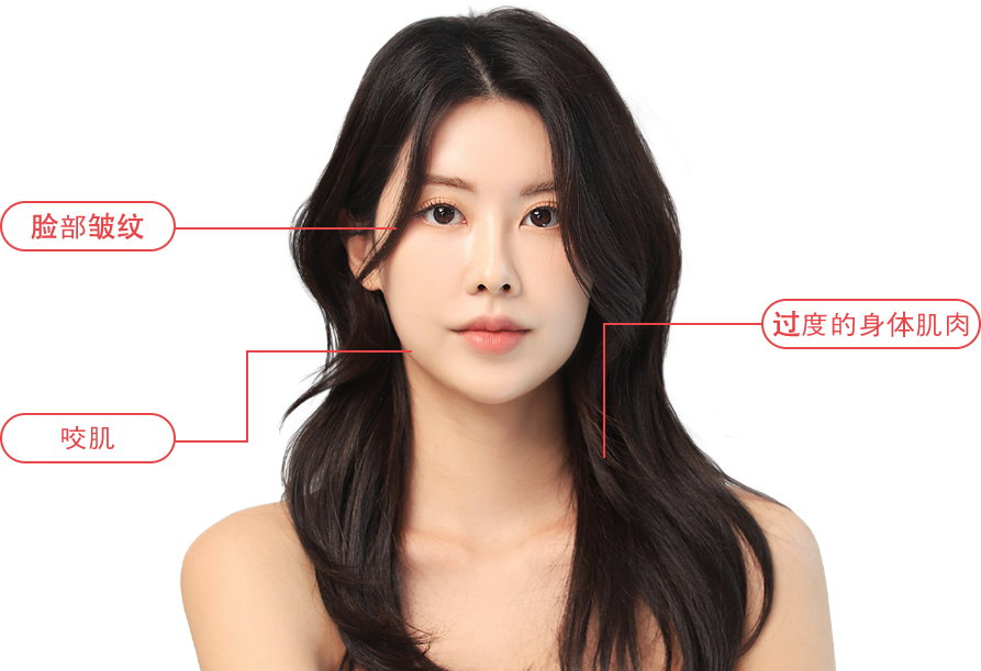 BotulinumToxin region model img