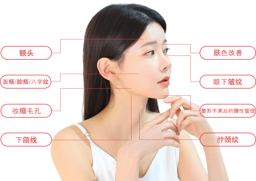 ulthera region model img