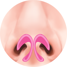 nose_type15