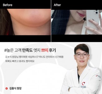 엣지성형외과&피부과 쁘띠 후기