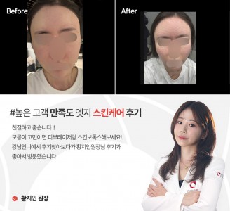 엣지성형외과&피부과 스킨케어 후기